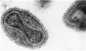 Phát hiện nhiều lọ nhỏ chứa virus gây bệnh đậu mùa