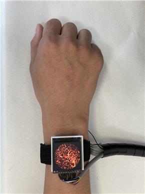 Công nghệ đeo tay đo huyết động theo thời gian thực